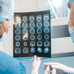 Surgery for Traumatic Injuries of the Brain