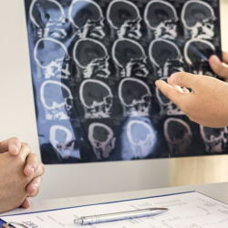 Pituitary Tumor Evaluation
