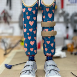 Upper and Lower Extremity Prosthetics