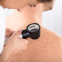 Medical Dermatology