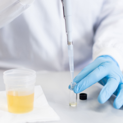 Drug Testing - Urine