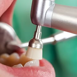 Oral Cancer Screenings