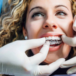 Invisalign