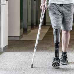 Amputation Rehab
