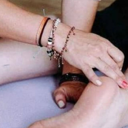 Community Acupuncture