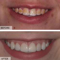Cosmetic Dentistry