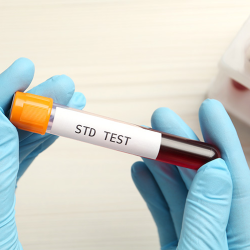 STI/STD Testing