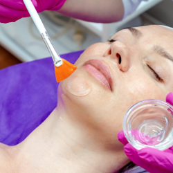 Chemical Peel