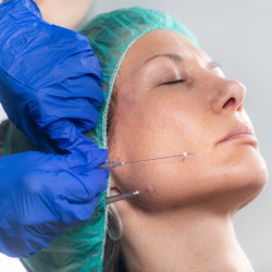 PDO threads Services