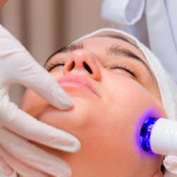 Laser Treatments