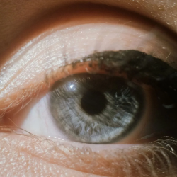 Dry Eye Therapy