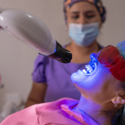 Whitening