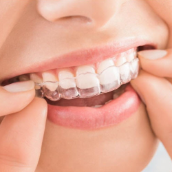 Cosmetic Dentistry