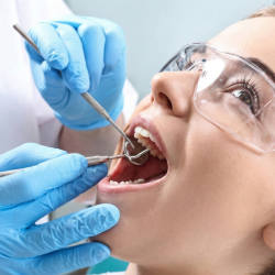 Teeth Cleaning & Dental Checkups