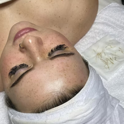 Facial Treatments