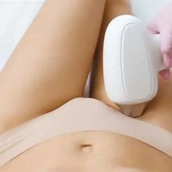 Laser Hair Removal
