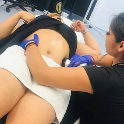 Ultrasound Cavitation