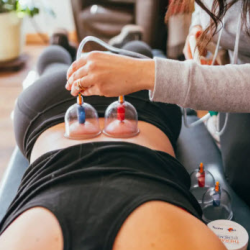 Cupping