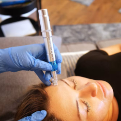 Microneedling with Herbal Serums