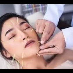 Cosmetic Acupuncture