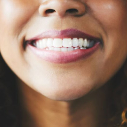 Tooth Extraction