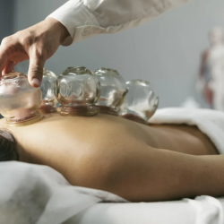 Cupping Therapy