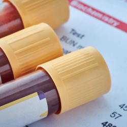 Drug Testing