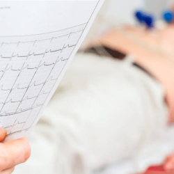 EKG Testing