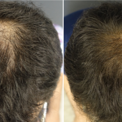 Derive Hair Treatment