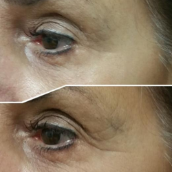 The Way to a More Youthful You!