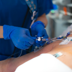 Vein Ablations