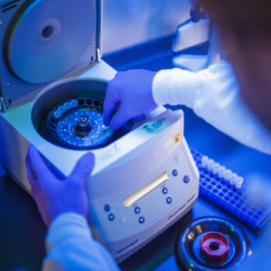 Oncotype DX Colon Recurrence Score® test