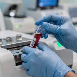 Food Sensitivity Testing