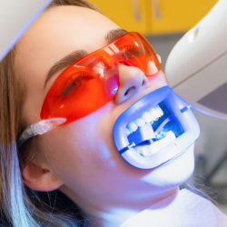 Tooth Whitening