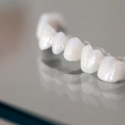 Porcelain Crowns