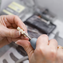 Dental Crowns and Bridges