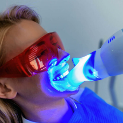 Teeth Whitening