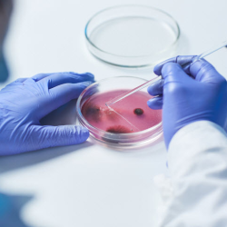 Bacteria Testing