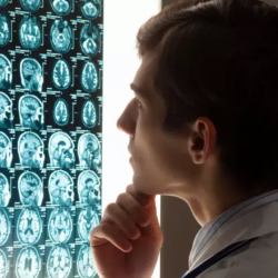 Traumatic Brain Injuries