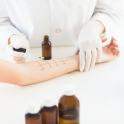 Allergy Testing