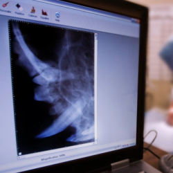 Advanced Diagnostics