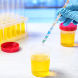 Drug Testing