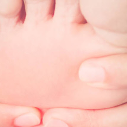 Diabetic Neuropathic Pain
