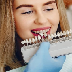 Dental Veneers