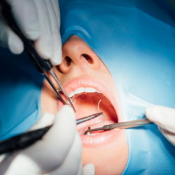 Oral Surgery