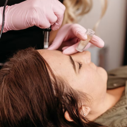 Microneedling