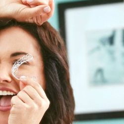 Clear Aligners (Motto® clear aligners)