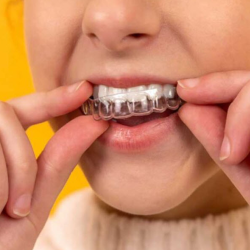 Retainers