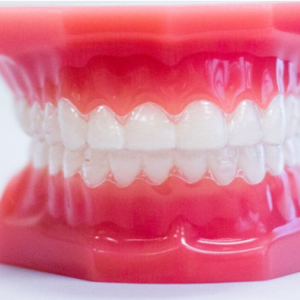 Invisalign Clear Aligners