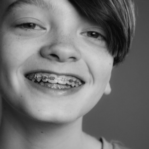 Traditional Braces
